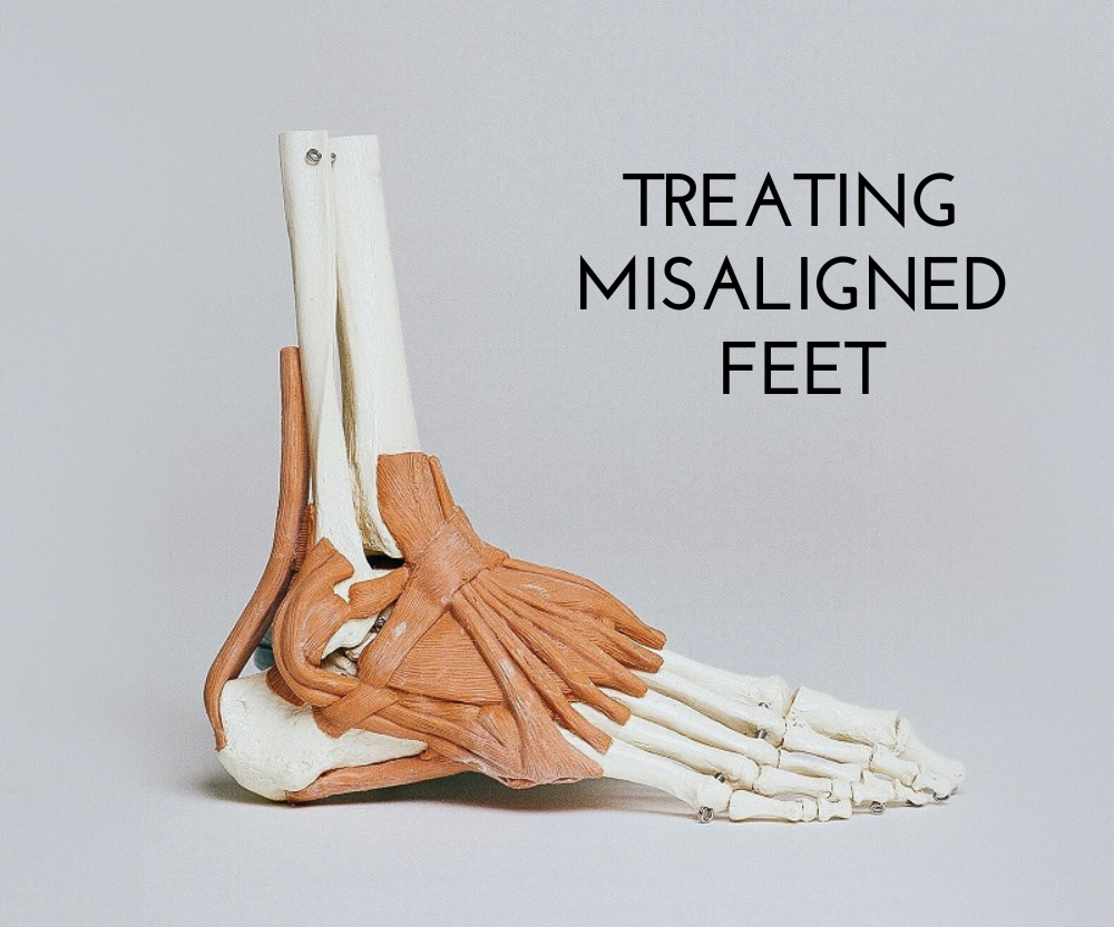 Treating Misaligned Feet | ETL Podiatry