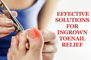Effective Solutions for Ingrown Toenail Relief